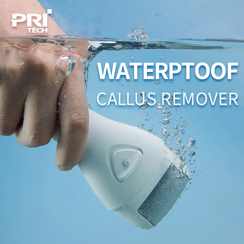 Electric Feet Callus Remover - Lusy Store LLC 