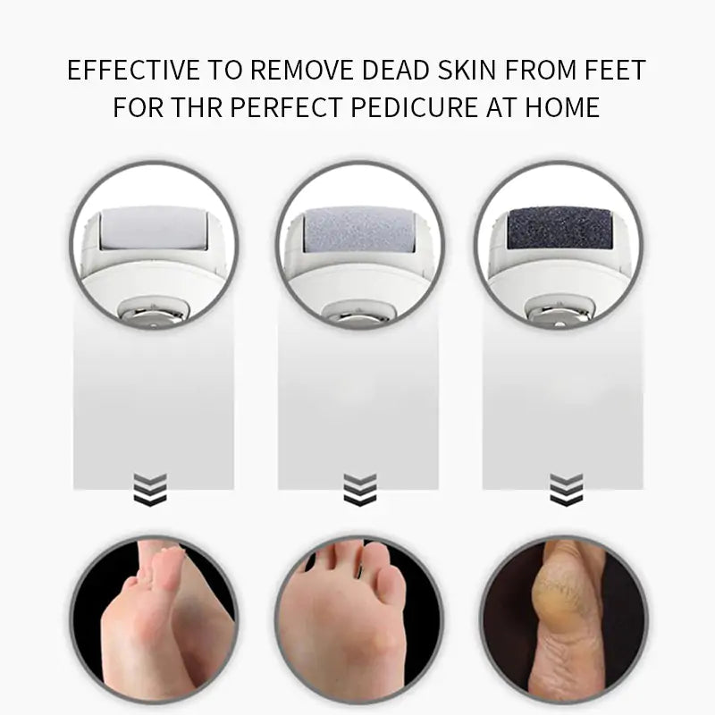 Electric Feet Callus Remover - Lusy Store LLC 
