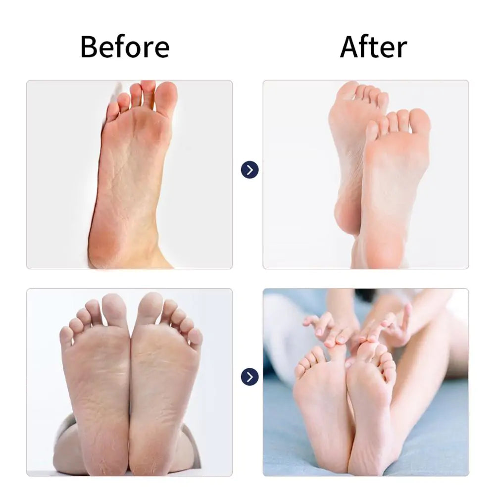 Electric Feet Callus Remover - Lusy Store LLC 