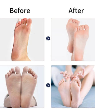 Electric Feet Callus Remover - Lusy Store LLC 